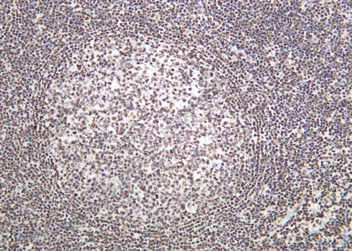 Recombinant Histone H3 (Acetyl Lys14) Monoclonal Antibody - 2