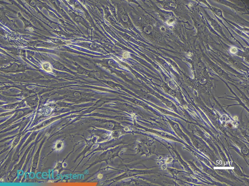 Human Endplate Chondrocyte Complete Medium - 5