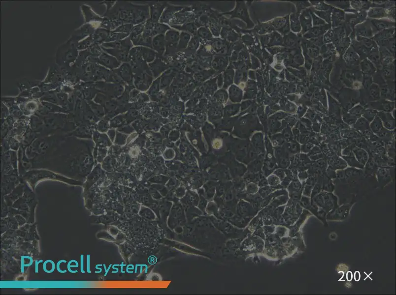 OE33 Cell Complete Medium - 5