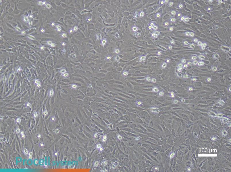 Rat Cerebral Artery Smooth Muscle Cell Complete Medium - 2