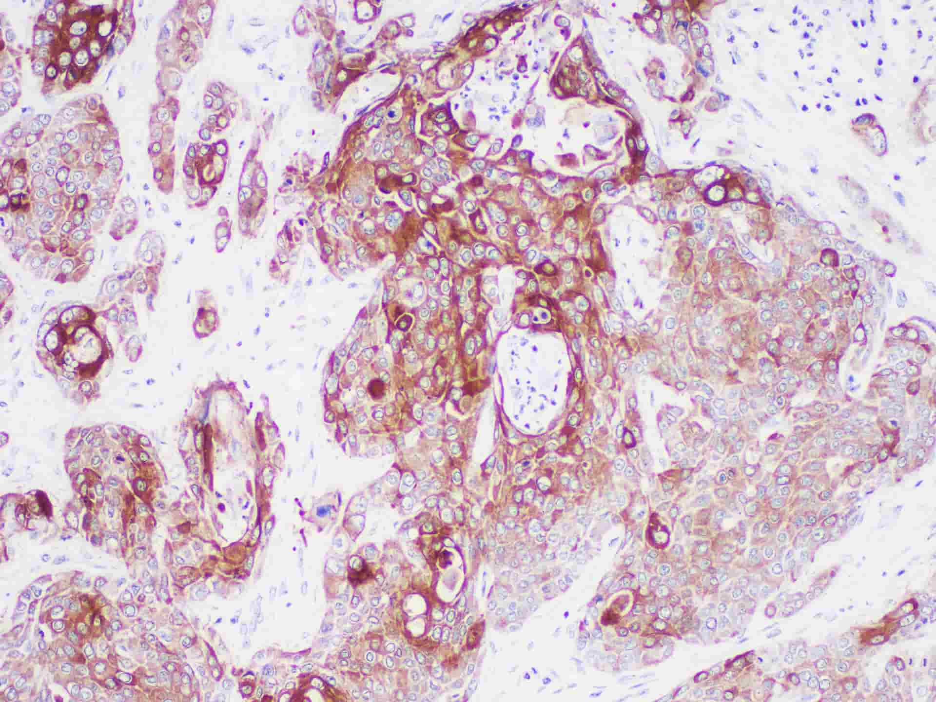 CK6 Monoclonal Antibody-searchlist-1