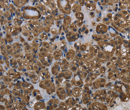 GSTP1 Polyclonal Antibody - 3