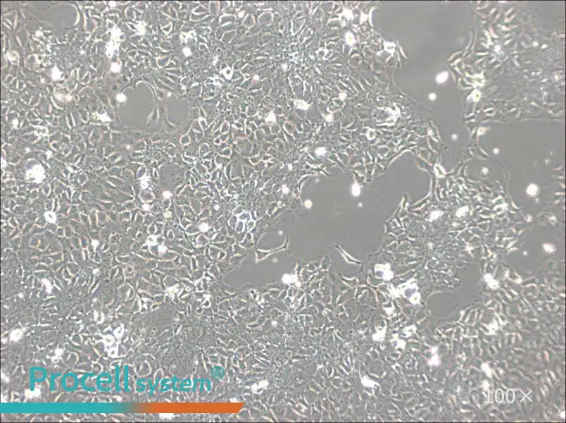 KYSE-140 Cell Complete MediumKYSE-140 Cell Complete Medium - 2