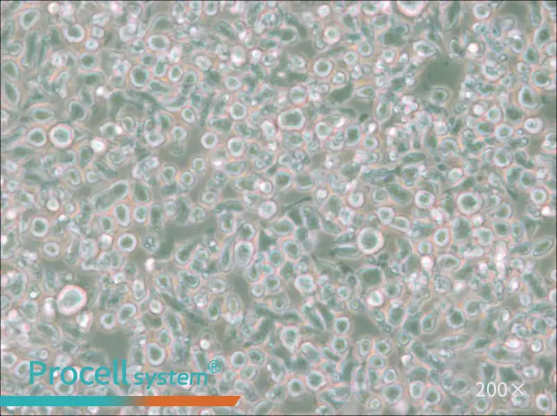 MM.1S Cell Complete Medium - small - 6