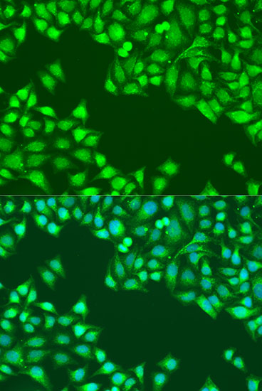 Immunofluorescence analysis of U2OS cells using JAK2 Polyclonal Antibody at dilution of 1:100. Blue: DAPI for nuclear staining.