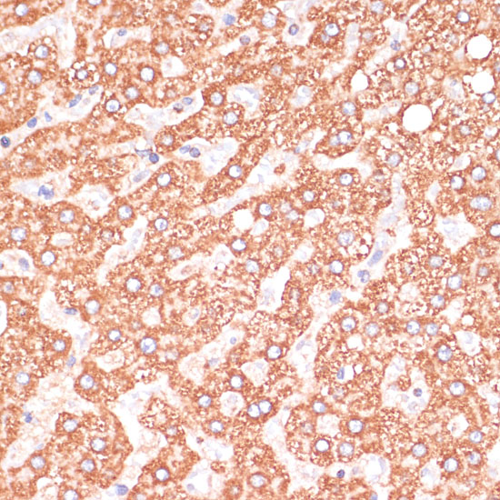 Immunohistochemistry of paraffin-embedded Human liver using Caspase-9 Polyclonal Antibody at dilution of 1:100 (40x lens).