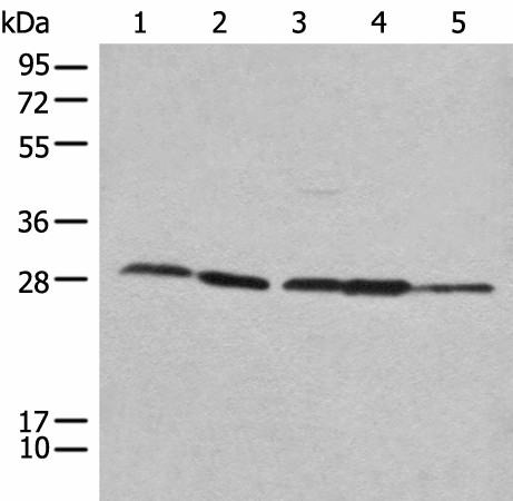 Western blot analysis of 293T Hela 231 HEPG2 and A431 cell lysates  using RPL14 Polyclonal Antibody at dilution of 1:800