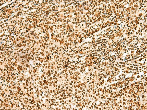 Immunohistochemistry of paraffin-embedded Human tonsil tissue  using HNRNPA3 Polyclonal Antibody at dilution of 1:45(?200)