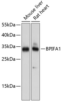 Western blot analysis of extracts of various cell lines using BPIFA1 Polyclonal Antibody at dilution of 1:1000.