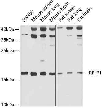 Western blot analysis of extracts of various cell lines using RPLP1 Polyclonal Antibody at 1:1000 dilution.