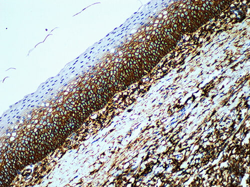 Immunohistochemistry of paraffinembedded Human tonsil tissue with CD44 Monoclonal Antibody(Antigen repaired by EDTA).