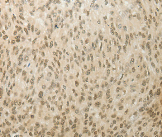 MYSM1 Polyclonal Antibody - 3