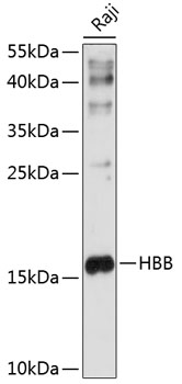 Western blot analysis of extracts of Raji cells using HBB Polyclonal Antibody at 1:1000 dilution.