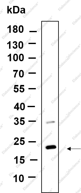 Recombinant CD81 Monoclonal Antibody - 1