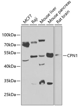 Western blot analysis of extracts of various cell lines using CPN1 Polyclonal Antibody at 1:1000 dilution.