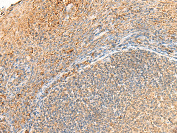 Immunohistochemistry of paraffin-embedded Human tonsil tissue  using GPR161 Polyclonal Antibody at dilution of 1:40(?200)