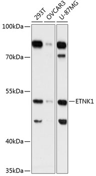 Western blot analysis of extracts of various cell lines using ETNK1 Polyclonal Antibody at 1:3000 dilution.