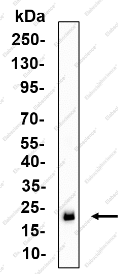 Recombinant Claudin 4 Monoclonal Antibody - 3