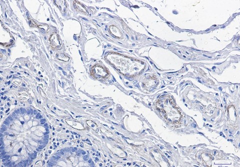 Recombinant CD146/MCAM Monoclonal Antibody - 2