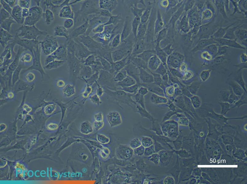 Rat Endplate ChondrocytesRat Endplate Chondrocytes - 3