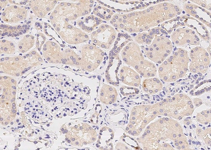 Epiphycan/DSPG3 Monoclonal Antibody-searchlist-1