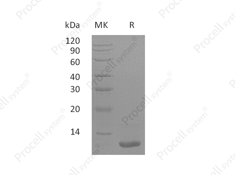 LR3-IGF-1/IGF1/IBP1 (MG), Human, Recombinant