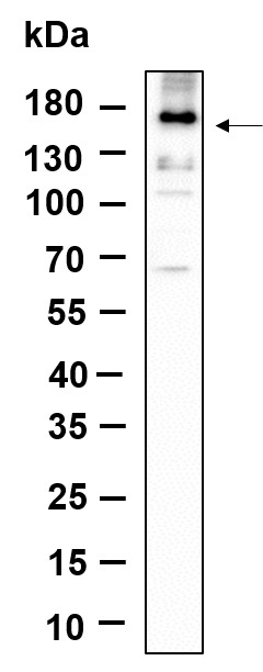 Recombinant Phospho-EGFR (Tyr1068) Monoclonal Antibody-searchlist-1