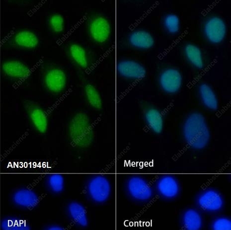 Recombinant RPA70 Monoclonal Antibody - 3
