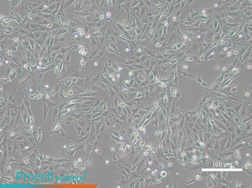 IBRS-2 [IB-RS-2]IBRS-2 [IB-RS-2] - 2
