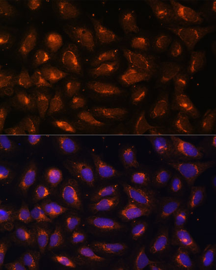 Immunofluorescence analysis of U-2 OS cells using CKMT1B Polyclonal antibody at dilution of 1:100 (40x lens). Blue: DAPI for nuclear staining.