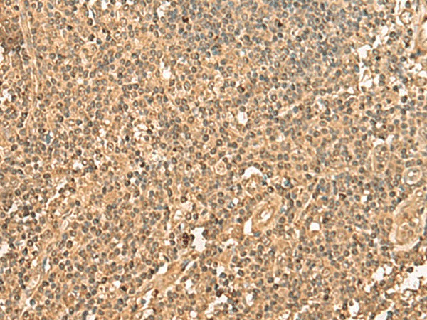 Immunohistochemistry of paraffin-embedded Human tonsil tissue  using PPM1G Polyclonal Antibody at dilution of 1:40(?200)