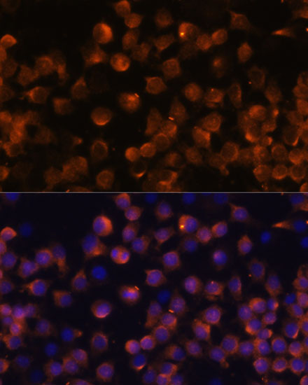 Immunofluorescence analysis of Raw264.7 cells using Complement Factor B Polyclonal Antibody at dilution of  1:100 (40x lens). Blue: DAPI for nuclear staining.