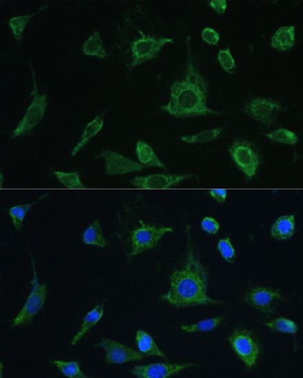 Immunofluorescence analysis of L-929 cells using Oncostatin M Polyclonal antibody at dilution of 1:100. Blue: DAPI for nuclear staining.