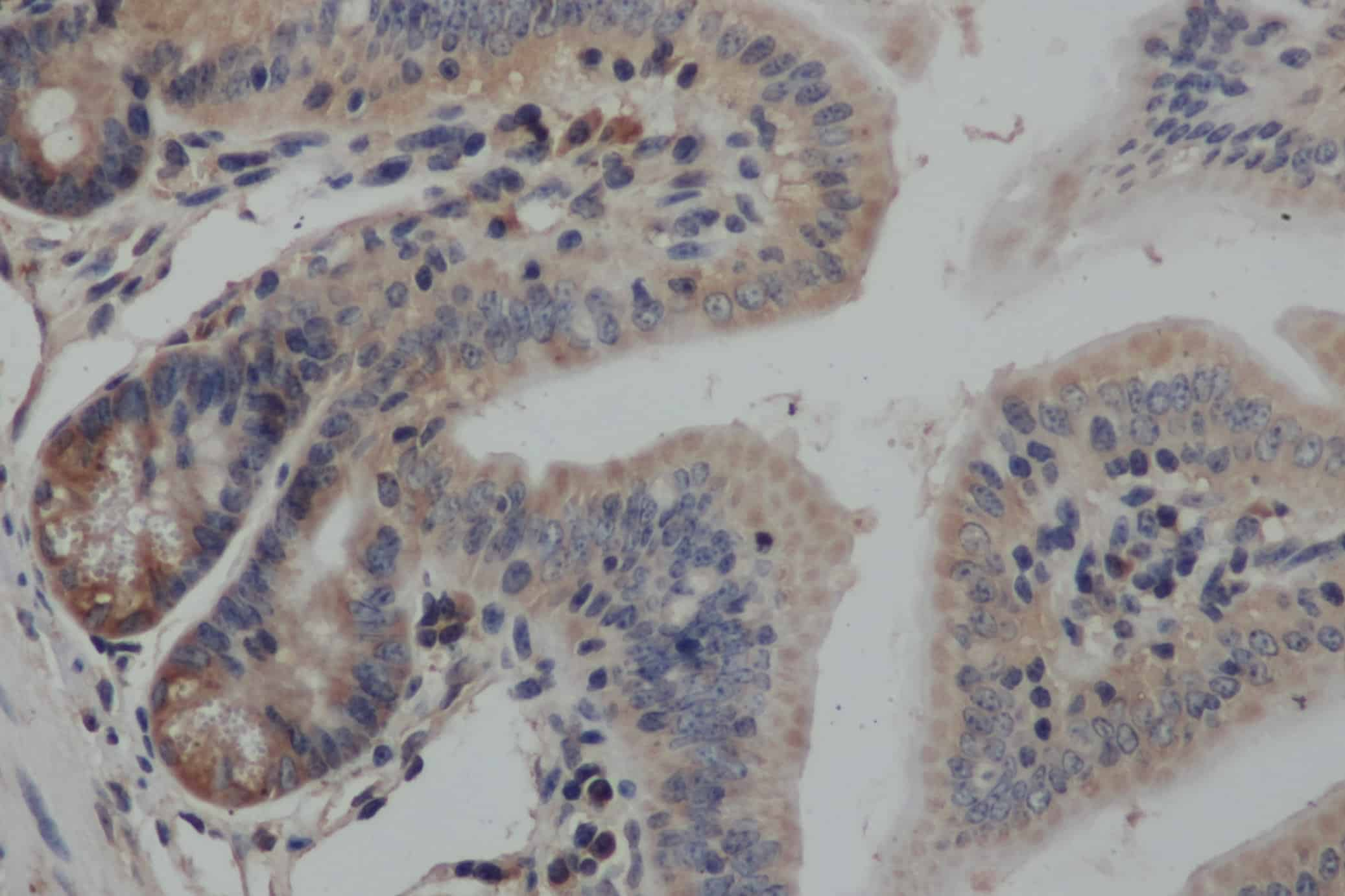 Immunohistochemistry of paraffin-embedded Mouse colon using SMAD3 Polyclonal Antibody at dilution of 1:50