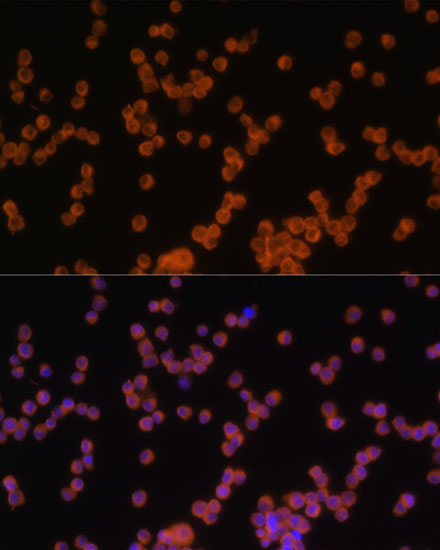 Immunofluorescence analysis of Raw264.7 cells using MyD88 Polyclonal Antibody at dilution of  1:100 (40x lens). Blue: DAPI for nuclear staining.