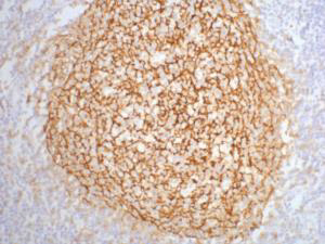 Immunohistochemistry of paraffin-embedded Human tonsil tissue using CD21 Monoclonal Antibody at dilution of 1:200.