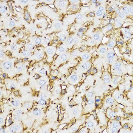 Immunohistochemistry of paraffin-embedded Mouse liver using YKL-40 / CHI3L1 Polyclonal Antibody at dilution of  1:100 (40x lens).