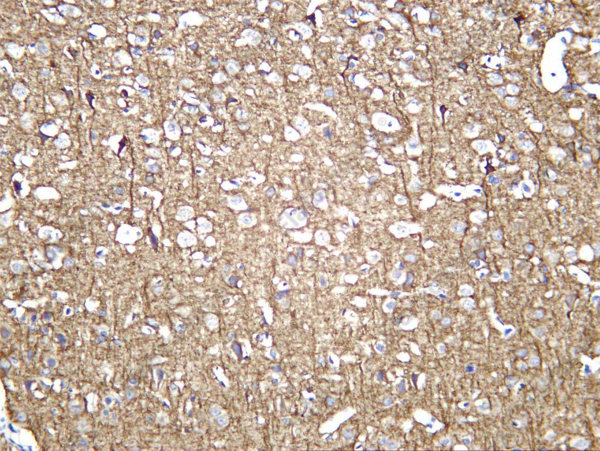 Recombinant Internexin α Monoclonal Antibody - 4