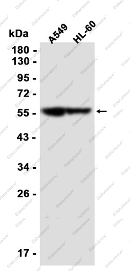 Recombinant SMARCD1 Monoclonal Antibody - 2