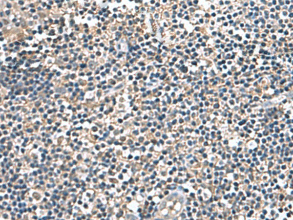 Immunohistochemistry of paraffin-embedded Human tonsil tissue  using IP6K2 Polyclonal Antibody at dilution of 1:140(?200)