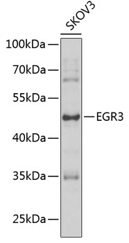 Western blot analysis of extracts of SKOV3 cells using EGR3 Polyclonal Antibody at 1:1000 dilution.