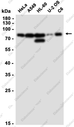 Recombinant RanGAP1 Monoclonal Antibody - 2