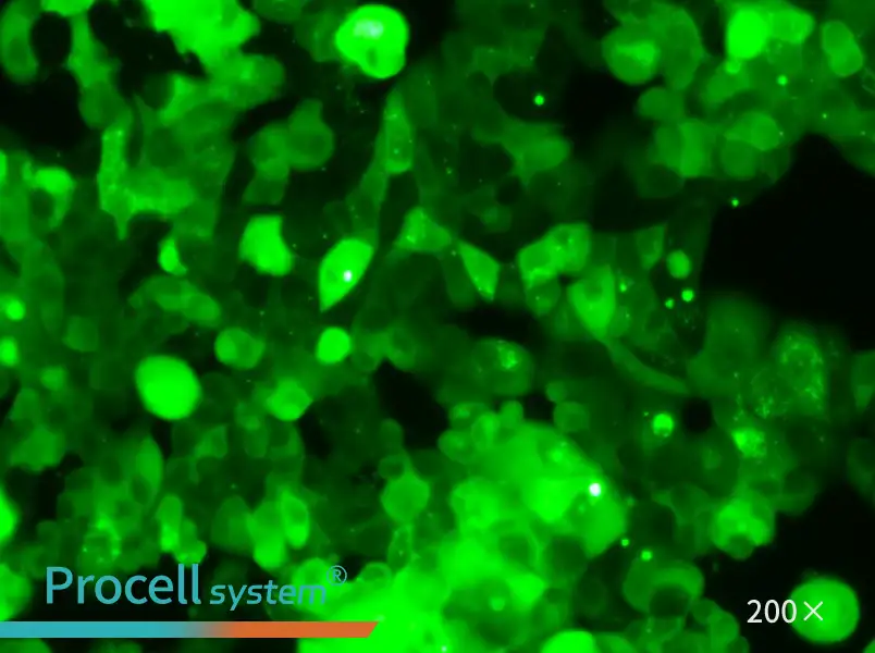MCF-7-GFP - 4