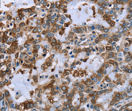 IMPDH2 Polyclonal Antibody - 3