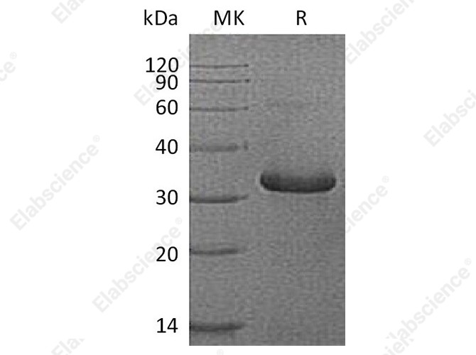 Recombinant Human IGFBP-1/IGFBP1 Protein (His Tag) - 1
