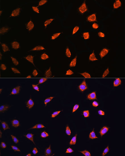 Immunofluorescence analysis of L929 cells using ART1 Polyclonal Antibody at dilution of  1:100. Blue: DAPI for nuclear staining.