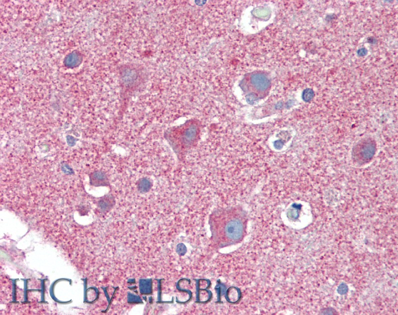 Immunohistochemistry of paraffin-embedded Brain, Cortex tissue using CLTC Polyclonal Antibody at dilution of 1:60(Elabscience Product Detected by Lifespan).