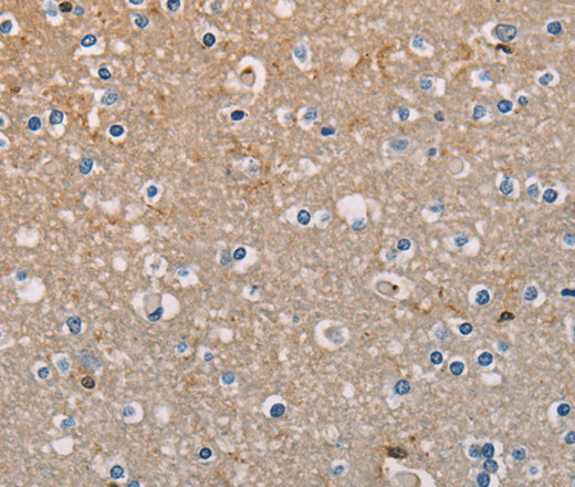 Immunohistochemistry of paraffin-embedded Human brain tissue using AMBRA1 Polyclonal Antibody at dilution 1:50