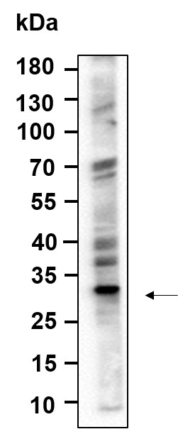 Recombinant ALKBH2 Monoclonal Antibody-searchlist-1