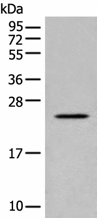 Western blot analysis of Human placenta tissue lysate  using CARD16 Polyclonal Antibody at dilution of 1:800